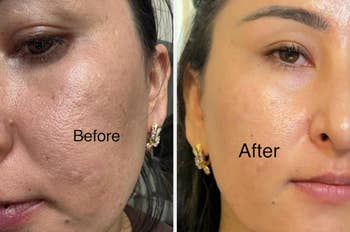 Close-up of a woman's skin showing a 