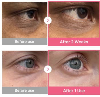 Before and after close-ups show reduced under-eye wrinkles after 2 weeks and 1 week of product use, demonstrating the product's effectiveness