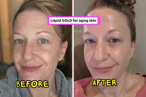Before and after shots of a woman showcasing skincare results with smoother, glowing skin. Text reads: 