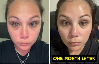 Before and after comparison of a woman's skincare regimen over one month, noting visible improvements in skin texture